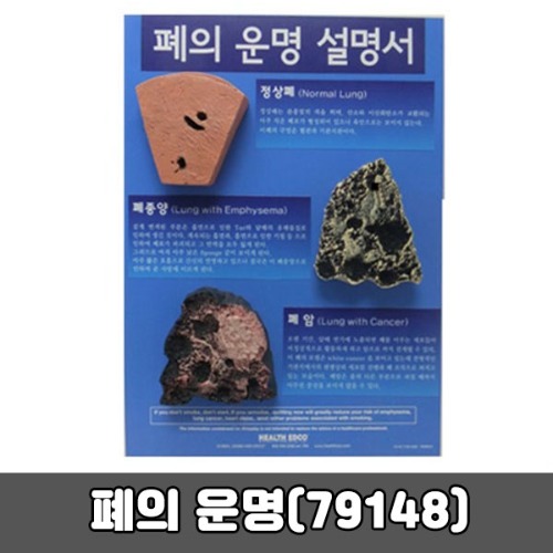 [SY] 폐의운명 (79148)  금연교육모형