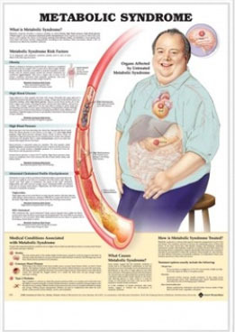 3D해부도(벽걸이)/ 9778 /대사증후군/( METABOLIC SYNDROME )