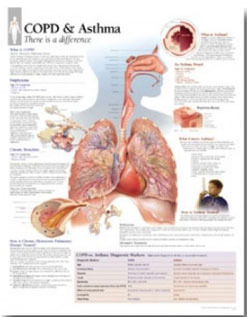 평면해부도 (벽걸이) /1355 /만성폐쇄성 폐질환 COPD &amp; Asthma /사이즈   56cm ⅹ 71cm Paper