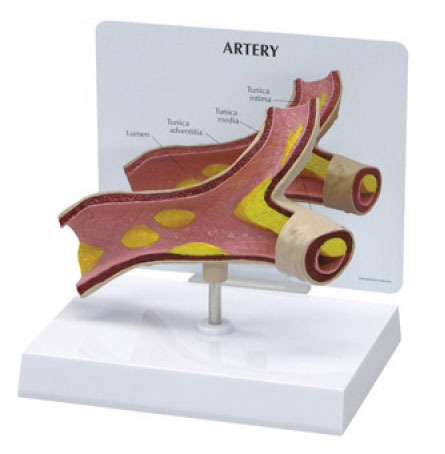 [GPI]동맥경화모형/G260/Artery Model 260/순환계모형