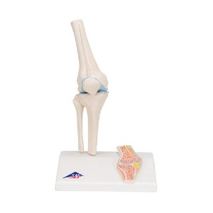 [3B] 단면 미니무릎관절모형 A85/1 (10x14x24cm/0.32kg)
