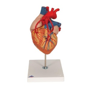 [3B] 4파트/2배 관상동맥 우회술 심장모형 G06 (32x18x18cm/0.99kg)