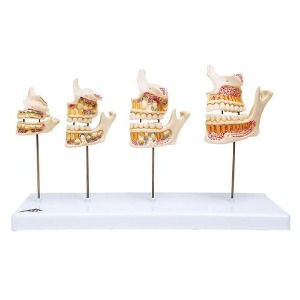 [3B] 치아발달모형 D20 (33x10x20cm/0.58kg) Dentition Development