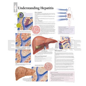 평면해부도(벽걸이)/ 1950 /간염의 이해/Understanding hepatitis / 사이즈   56cm ⅹ 71cm Paper