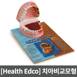 [SY] 치아비교모형 79650