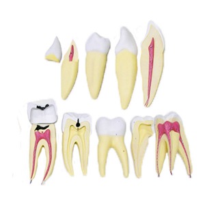 치아 8배 확대모형 EBK-E0004(EBK3-317) 치아모형 치아의 구조