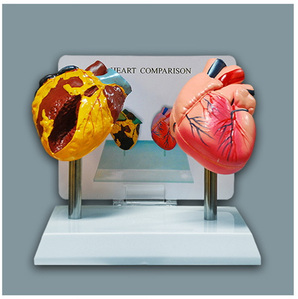 [S3039] 심장비교모형/my-B110/흡연자 심장비교모형,흡연자심장모형 금연교육