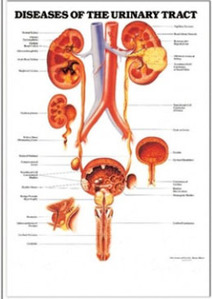 3D해부도(벽걸이)/ 9797/배뇨기의 질병( DISEASES OF THE URINARY TRACT )