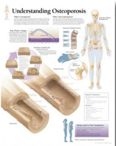 평면해부도(벽걸이) / 1153 /골다공증Understanding Osteoporosis/사이즈   56cm ⅹ 71cm Paper