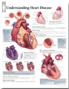 평면해부도(벽걸이)/1454/심장질환의 이해 Understanding Heart Disease / 사이즈   56cm ⅹ 71cm Paper