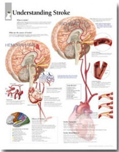 평면해부도 (벽걸이)/ 1455/뇌졸증의 이해 Understanding Stroke / 사이즈   56cm ⅹ 71cm Paper