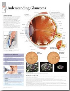 평면해부도(벽걸이)/ 2250 /녹내장/Understanding Glaucoma / 사이즈   56cm ⅹ 71cm Paper