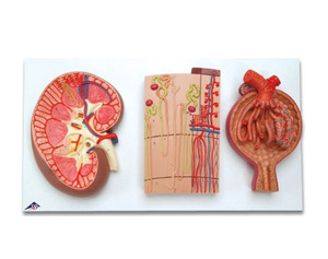 [3B] 신사단면모형 K11 (29x52x9cm/2.55kg) Kidney Section, Nephrons, Blood Vessels and Renal Corpuscle