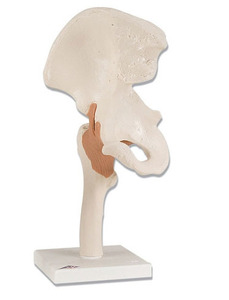 [3B] 고관절모형 A81 (17x12x33cm/0.74kg) Functional Hip Joint