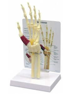 [GPI]  손목터널 증후군모형(G192)/ Hand/Wrist 192  Carpal Tunnel Syndrome