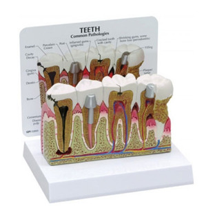 [GPI]치아모형/G286/Teeth 286/치아관리 실습모형