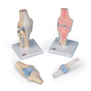 [3B] 3파트 부분적슬관절모형 A89 (12x12x24cm/0.71kg) Sectional Knee Joint Model