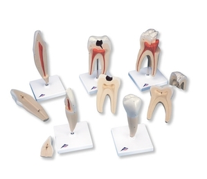 [3B] 5가지 타입 치아모형 D10 (29cm/0.22kg) Classic Tooth Model Series, 5 models