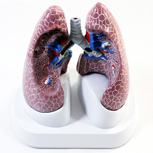 [GPI] 흡연자의폐 폐질환모형G52/ 54171 금연교육
