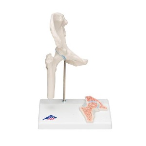 [3B] 소형 고관절모형 A84/1 (16x12x20cm/0.29kg) Mini Hip Joint with cross-section
