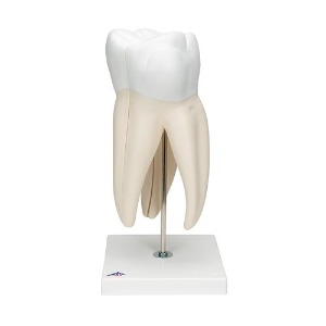 [3B] 상악대구치모형 D15 (24x12x13cm/1.3kg) Giant Molar with Dental Cavities, 6 part
