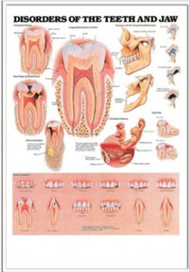 3D해부도(벽걸이)/ 9866M/치과챠트/( DISORDERS OF THE TEETH AND JAW )